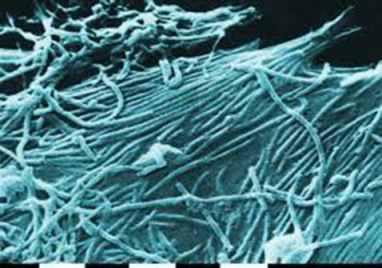 Electron microscope image of the the Ebola virus 