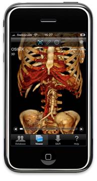 An image showing the Osirix DICOM Viewer on Apple iPhone.