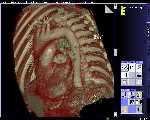 Siemens 64-slice CT scan of heart