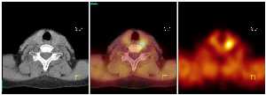 Images from a SPECT-CT scanner